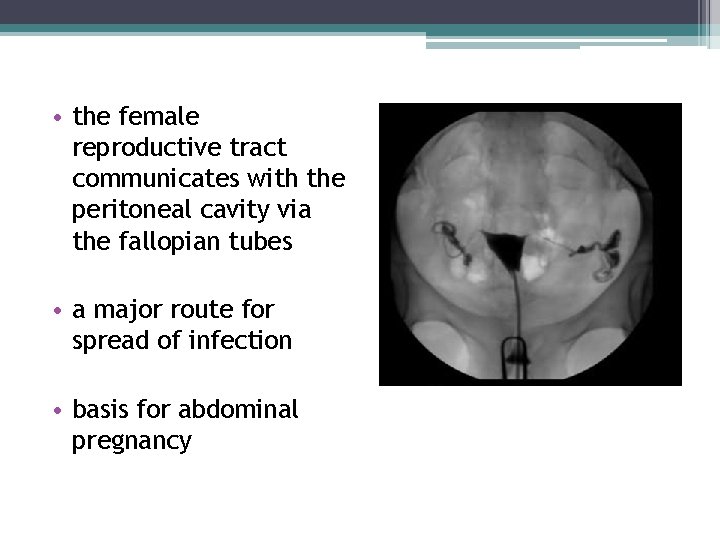 • the female reproductive tract communicates with the peritoneal cavity via the fallopian • the female reproductive tract communicates with the peritoneal cavity via the fallopian
