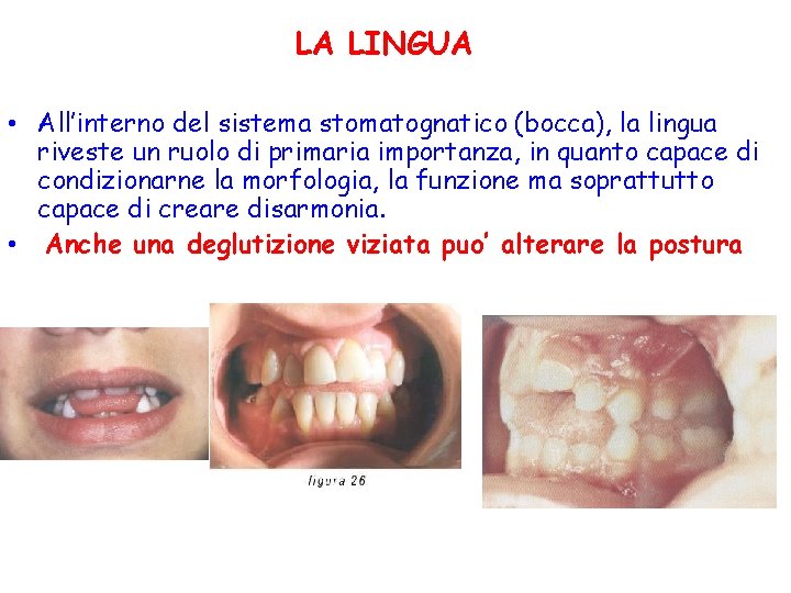 LA LINGUA • All’interno del sistema stomatognatico (bocca), la lingua riveste un ruolo di