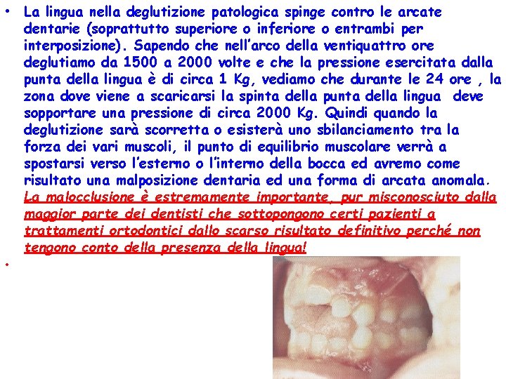  • La lingua nella deglutizione patologica spinge contro le arcate dentarie (soprattutto superiore
