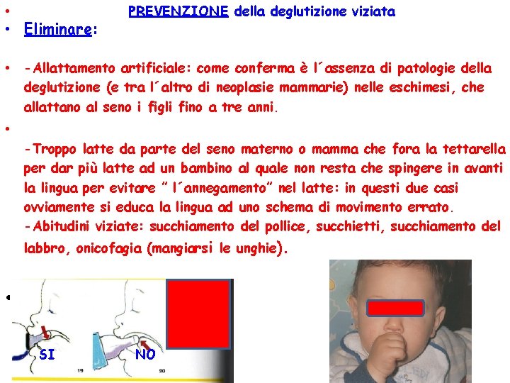  • • Eliminare: • PREVENZIONE della deglutizione viziata -Allattamento artificiale: come conferma è