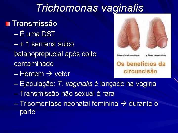 Trichomonas vaginalis Transmissão – É uma DST – + 1 semana sulco balanoprepucial após