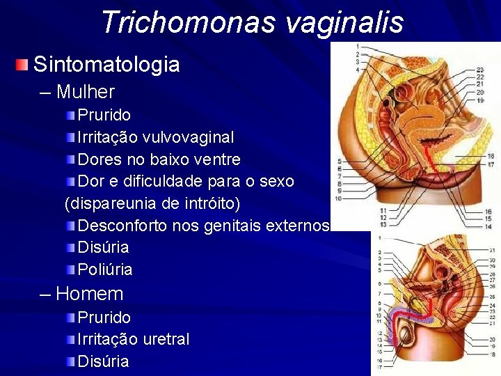 Trichomonas vaginalis Sintomatologia – Mulher Prurido Irritação vulvovaginal Dores no baixo ventre Dor e