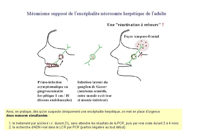 Mécanisme supposé de l’encéphalite nécrosante herpétique de l’adulte Ainsi, en pratique, dès qu'on suspecte