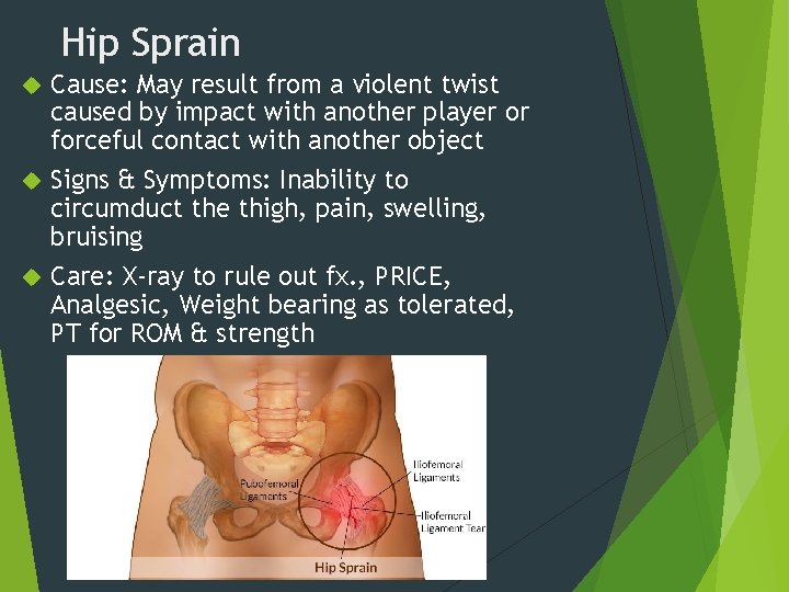 Hip Sprain Cause: May result from a violent twist caused by impact with another