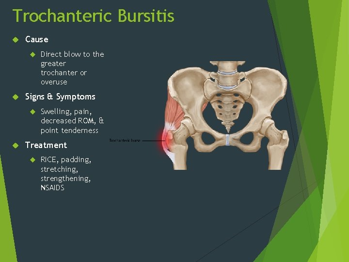 Trochanteric Bursitis Cause Signs & Symptoms Direct blow to the greater trochanter or overuse