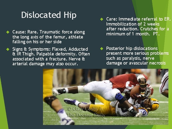 Dislocated Hip Cause: Rare. Traumatic force along the long axis of the femur, athlete