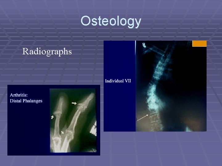 Osteology Radiographs 