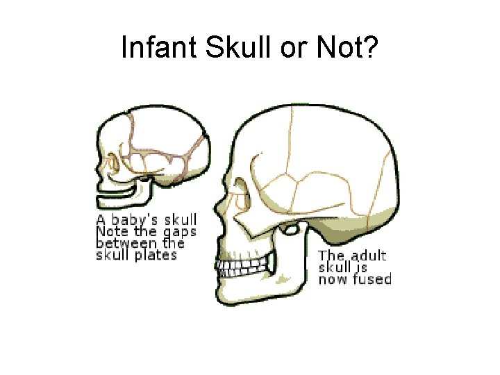 Infant Skull or Not? 