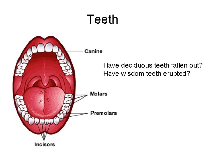 Teeth Have deciduous teeth fallen out? Have wisdom teeth erupted? 