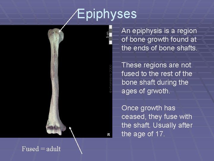 Epiphyses An epiphysis is a region of bone growth found at the ends of