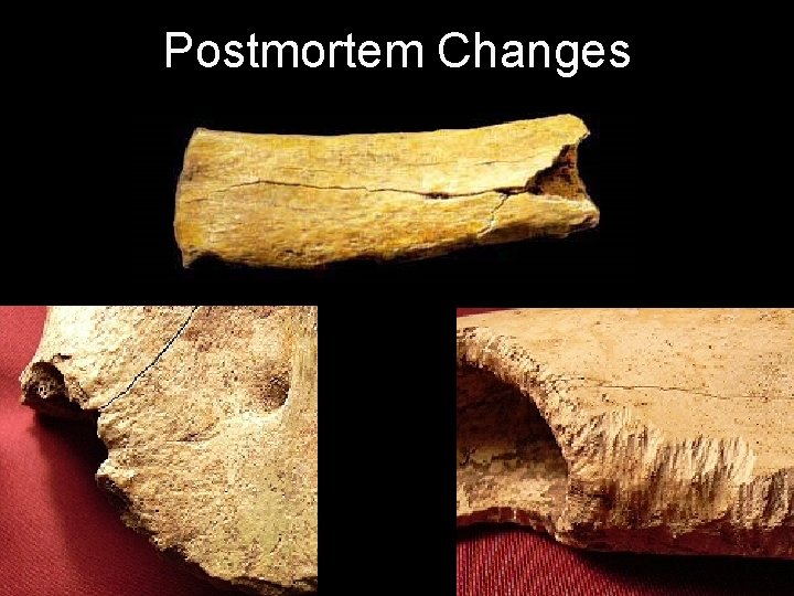 Postmortem Changes 