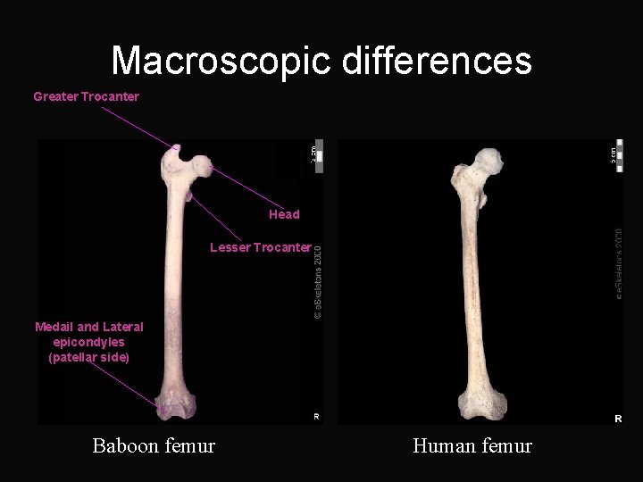 Macroscopic differences Greater Trocanter Head Lesser Trocanter Medail and Lateral epicondyles (patellar side) Baboon
