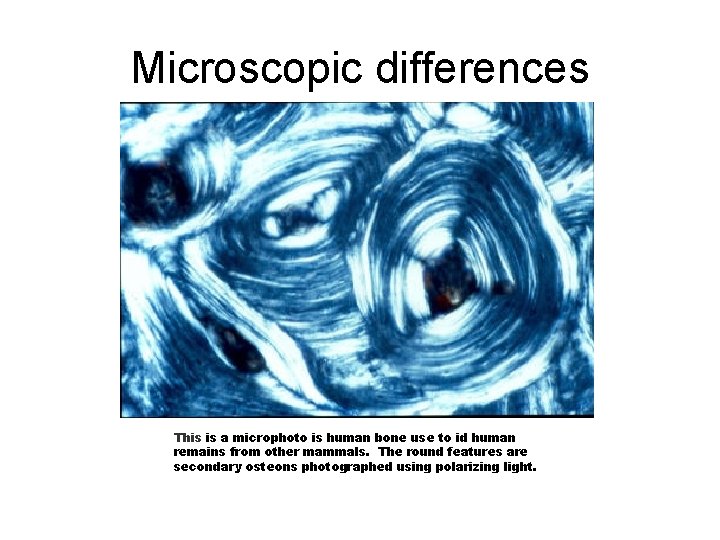 Microscopic differences This is a microphoto is human bone use to id human remains
