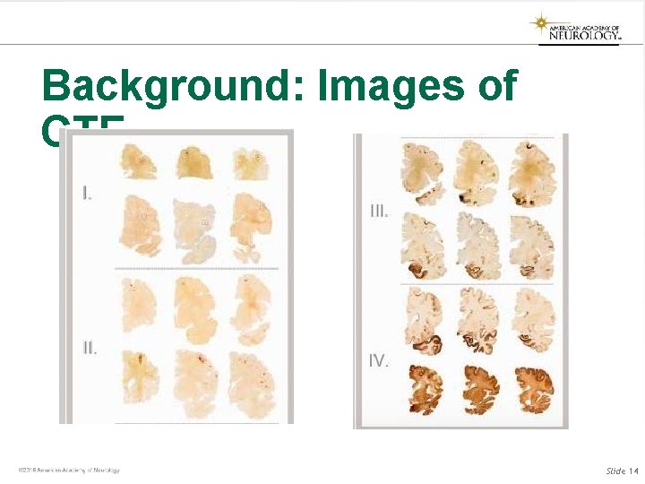 Background: Images of CTE Slide 14 Background: Images of CTE Slide 14