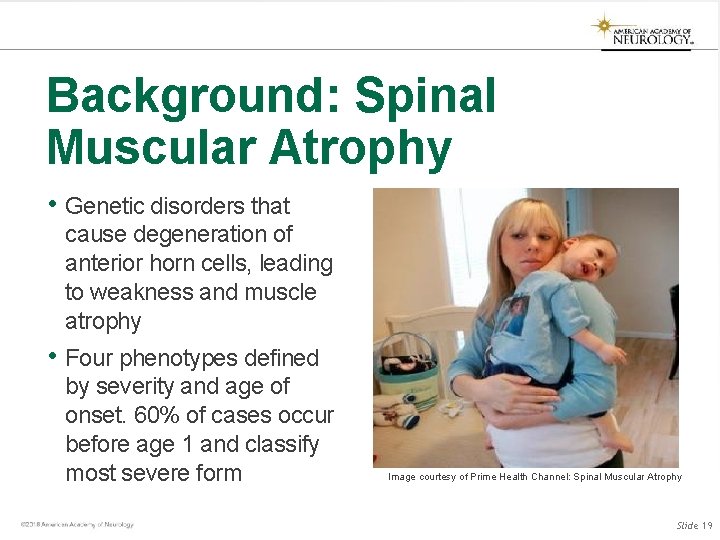 Background: Spinal Muscular Atrophy • Genetic disorders that cause degeneration of anterior horn cells, Background: Spinal Muscular Atrophy • Genetic disorders that cause degeneration of anterior horn cells,