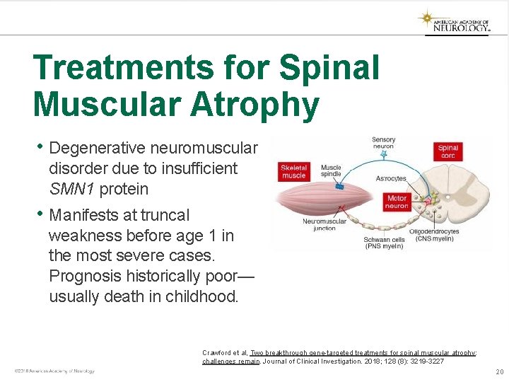 Treatments for Spinal Muscular Atrophy • Degenerative neuromuscular disorder due to insufficient SMN 1 Treatments for Spinal Muscular Atrophy • Degenerative neuromuscular disorder due to insufficient SMN 1