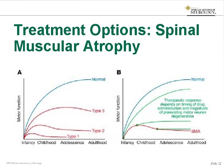 Treatment Options: Spinal Muscular Atrophy Slide 22 Treatment Options: Spinal Muscular Atrophy Slide 22