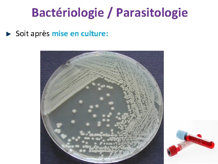 Bactériologie / Parasitologie Soit après mise en culture: 