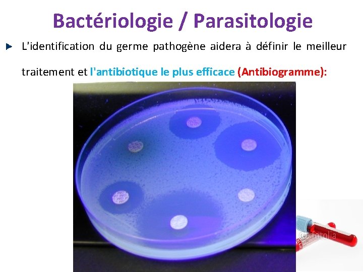 Bactériologie / Parasitologie L'identification du germe pathogène aidera à définir le meilleur traitement et