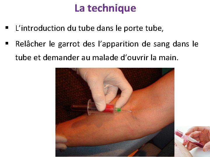 La technique § L’introduction du tube dans le porte tube, § Relâcher le garrot