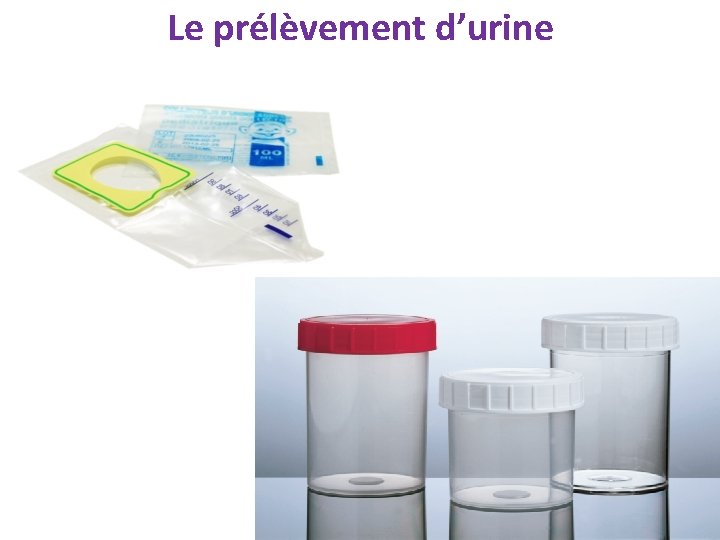 Le prélèvement d’urine 