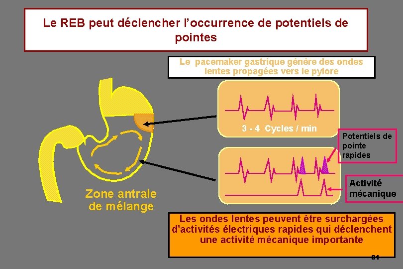 Le REB peut déclencher l’occurrence de potentiels de pointes Le pacemaker gastrique génère des