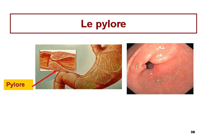 Le pylore Pylore 35 