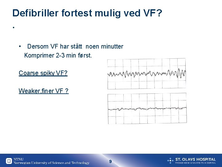 Defibriller fortest mulig ved VF? . • Dersom VF har stått noen minutter Komprimer