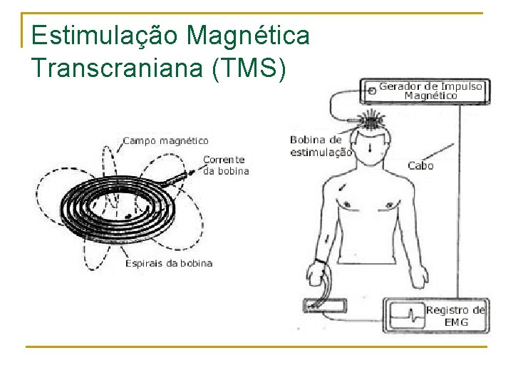 Estimulação Magnética Transcraniana (TMS) 