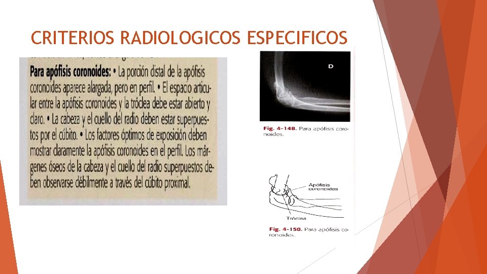 CRITERIOS RADIOLOGICOS ESPECIFICOS 