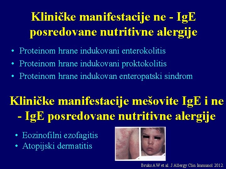 Kliničke manifestacije ne - Ig. E posredovane nutritivne alergije • • • Proteinom hrane