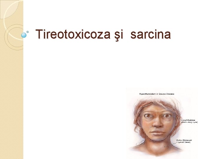 Tireotoxicoza şi sarcina 