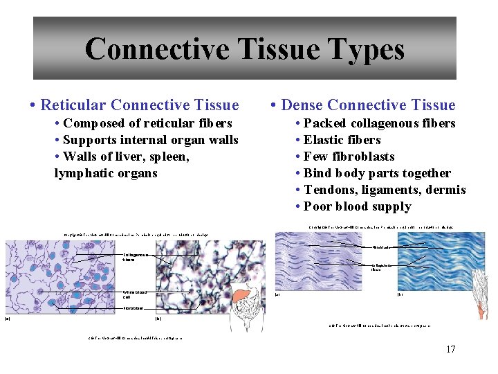 Connective Tissue Types • Reticular Connective Tissue • Dense Connective Tissue • Composed of