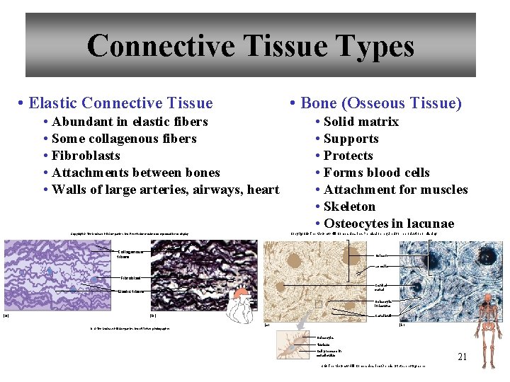 Connective Tissue Types • Elastic Connective Tissue • Bone (Osseous Tissue) • Abundant in