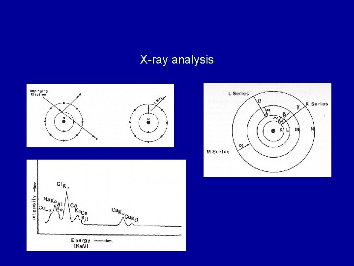 X-ray analysis X-ray analysis