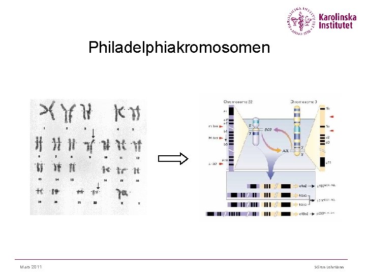 Philadelphiakromosomen Mars 2011 Sören Lehmann 