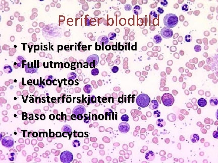 Perifer blodbild • Typisk perifer blodbild • Full utmognad • Leukocytos • Vänsterförskjuten diff