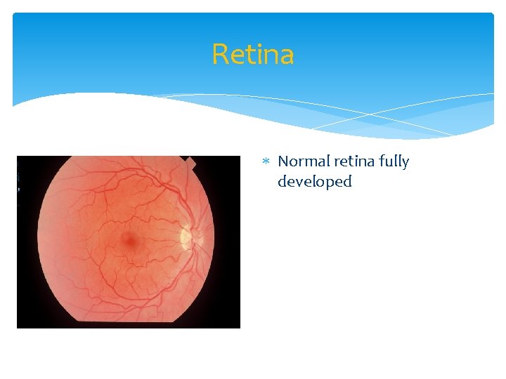 Retina Normal retina fully developed 
