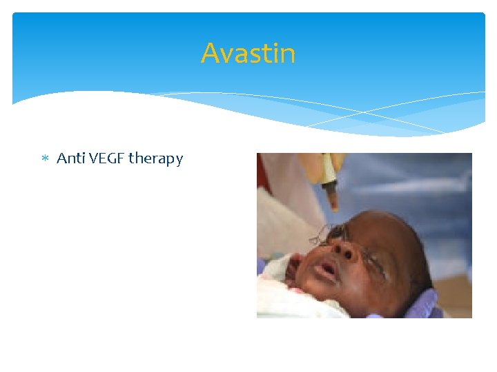 Avastin Anti VEGF therapy 