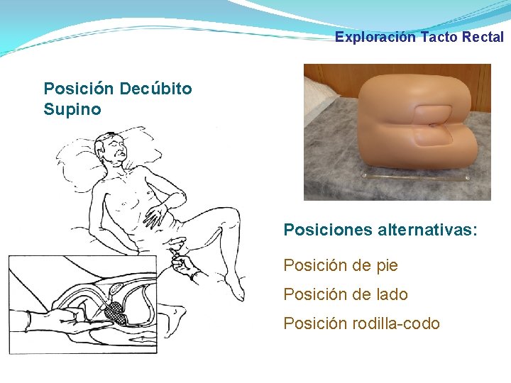 Exploración Tacto Rectal Posición Decúbito Supino Posiciones alternativas: Posición de pie Posición de lado Exploración Tacto Rectal Posición Decúbito Supino Posiciones alternativas: Posición de pie Posición de lado