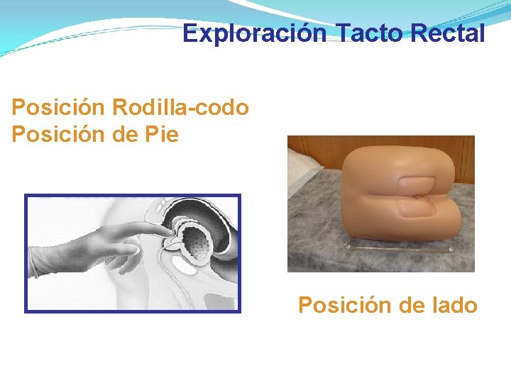 Exploración Tacto Rectal Posición Rodilla-codo Posición de Pie Posición de lado Exploración Tacto Rectal Posición Rodilla-codo Posición de Pie Posición de lado