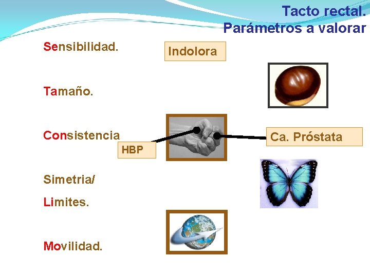Tacto rectal. Parámetros a valorar Sensibilidad. Indolora Tamaño. Consistencia Ca. Próstata HBP Simetria/ Limites. Tacto rectal. Parámetros a valorar Sensibilidad. Indolora Tamaño. Consistencia Ca. Próstata HBP Simetria/ Limites.