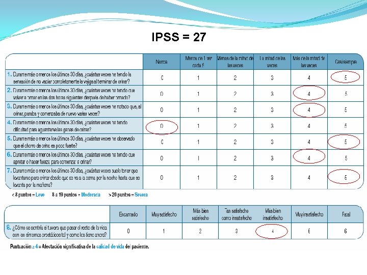IPSS = 27 IPSS = 27