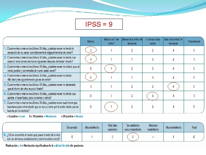 IPSS = 9 IPSS = 9