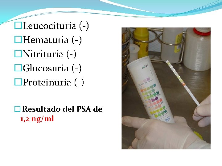 � Leucocituria (-) � Hematuria (-) � Nitrituria (-) � Glucosuria (-) � Proteinuria � Leucocituria (-) � Hematuria (-) � Nitrituria (-) � Glucosuria (-) � Proteinuria