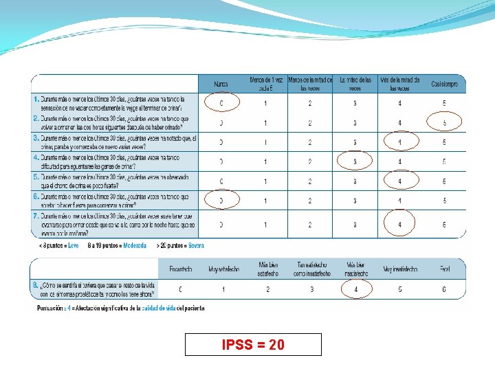 IPSS = 20 IPSS = 20