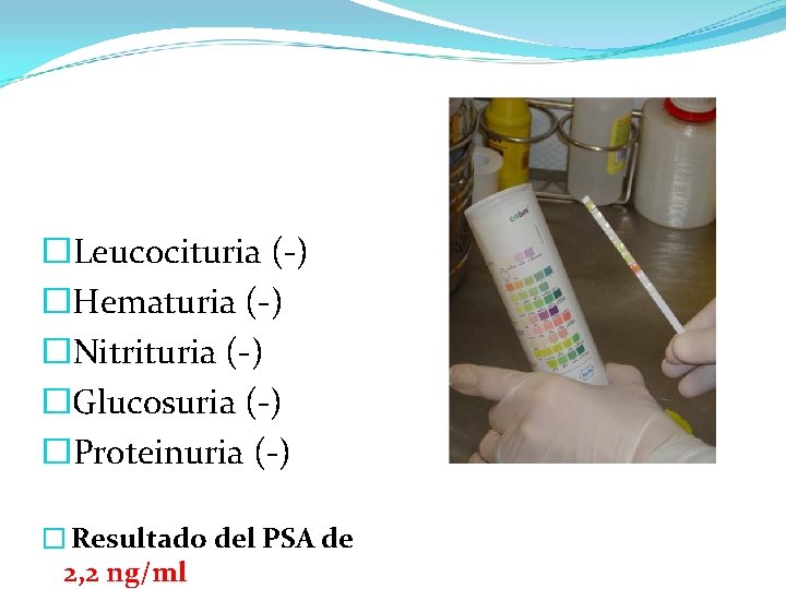 � Leucocituria (-) � Hematuria (-) � Nitrituria (-) � Glucosuria (-) � Proteinuria � Leucocituria (-) � Hematuria (-) � Nitrituria (-) � Glucosuria (-) � Proteinuria