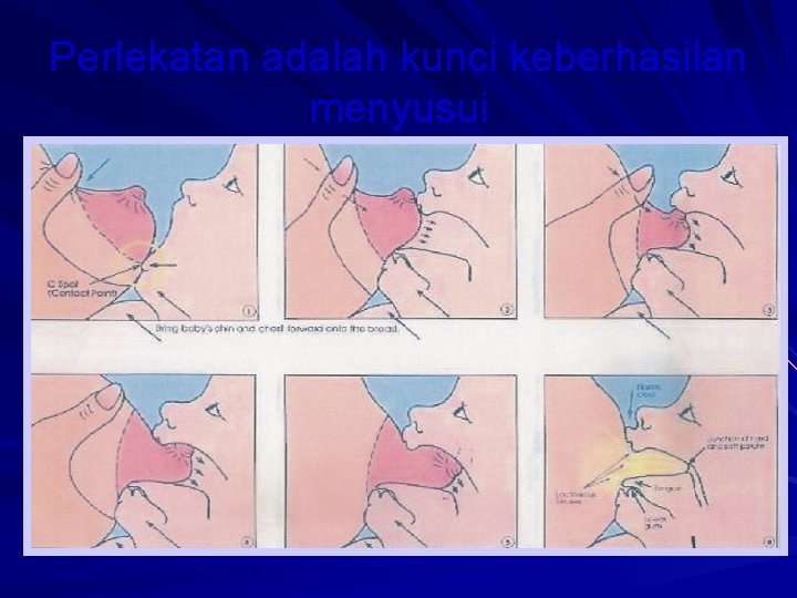 Perlekatan adalah kunci keberhasilan menyusui 