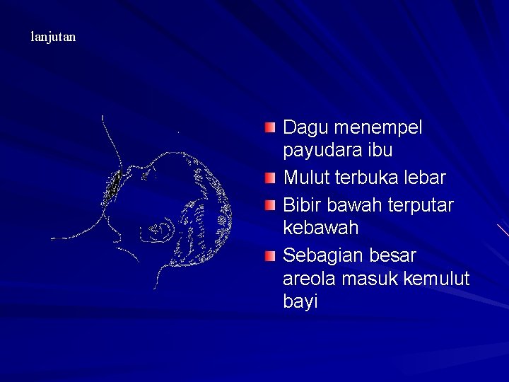 lanjutan Dagu menempel payudara ibu Mulut terbuka lebar Bibir bawah terputar kebawah Sebagian besar