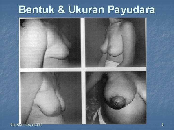 Bentuk & Ukuran Payudara Eny Qurniyawati, SST 6 